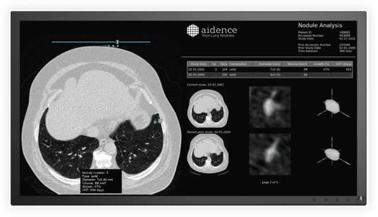 ai screen